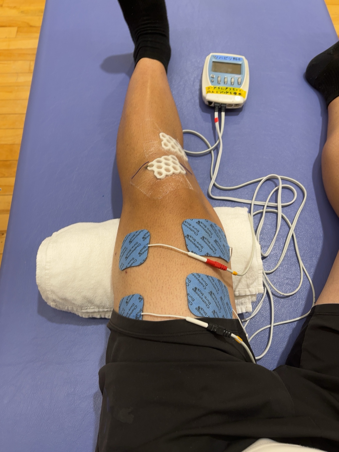 「リハビリ風景｜電気治療で太もも前の筋肉を刺激し、膝伸展を促すリハビリ中の様子」