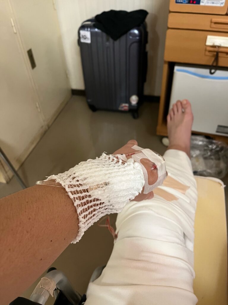 点滴を外しガーゼで保護された手