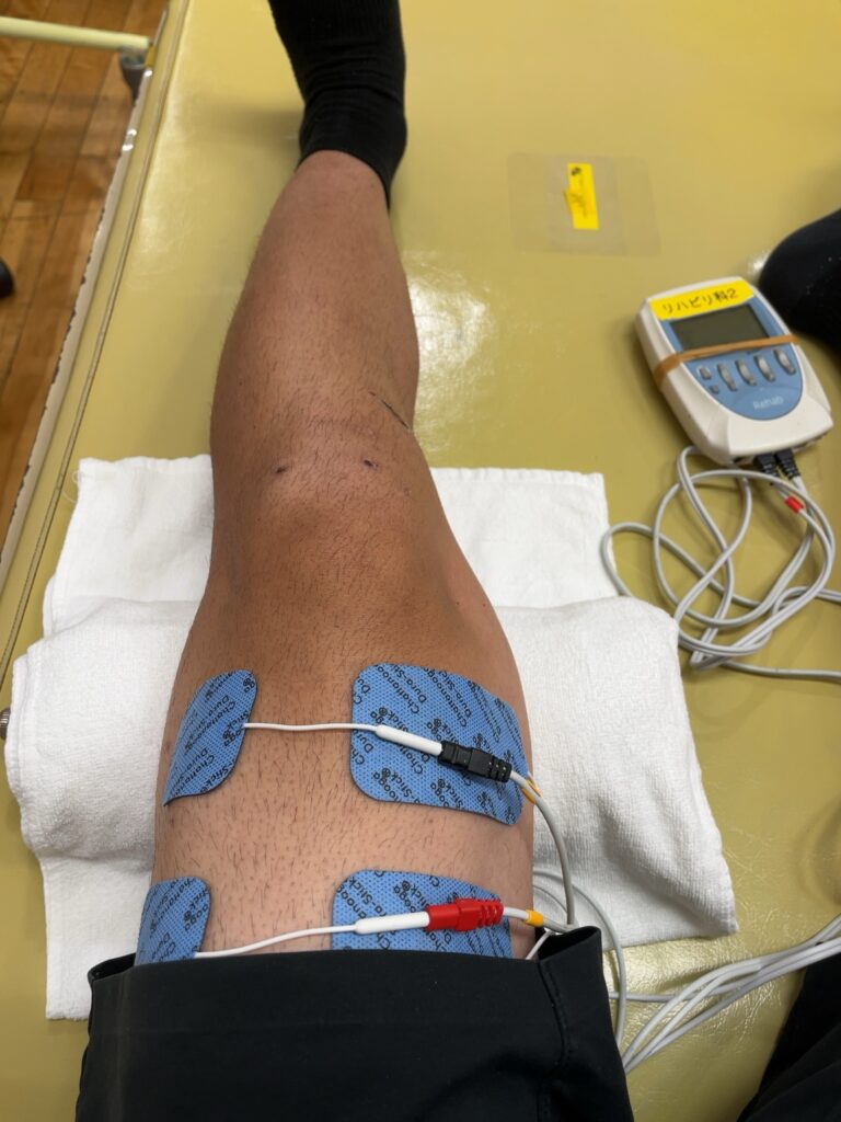 ACL術後15日目の電気治療の様子