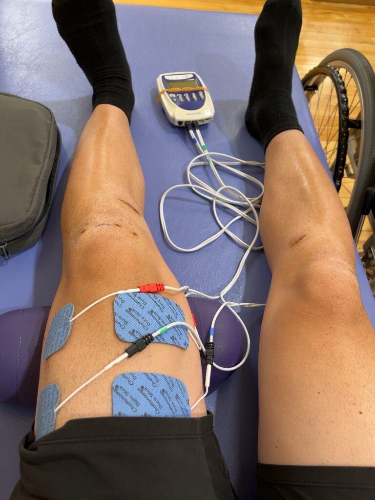 ACL術後12日目のリハビリ風景(電気治療によるもも前トレーニング)