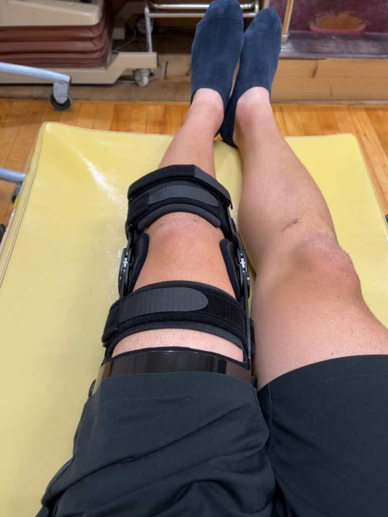 ACL術後14日目 DONJOY装具を装着した膝でのリハビリ風景