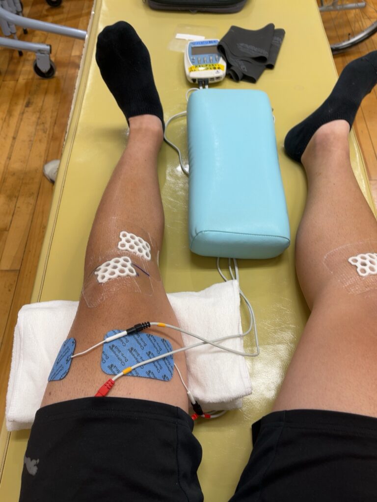 「大腿四頭筋への電気刺激によるリハビリ風景」
